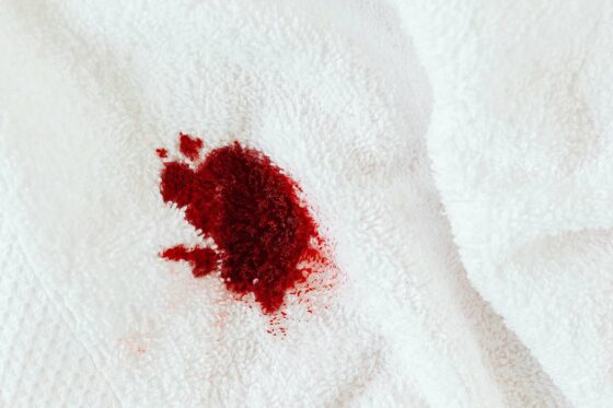 Image d'une tache de sang sur une serviette de bain blanche